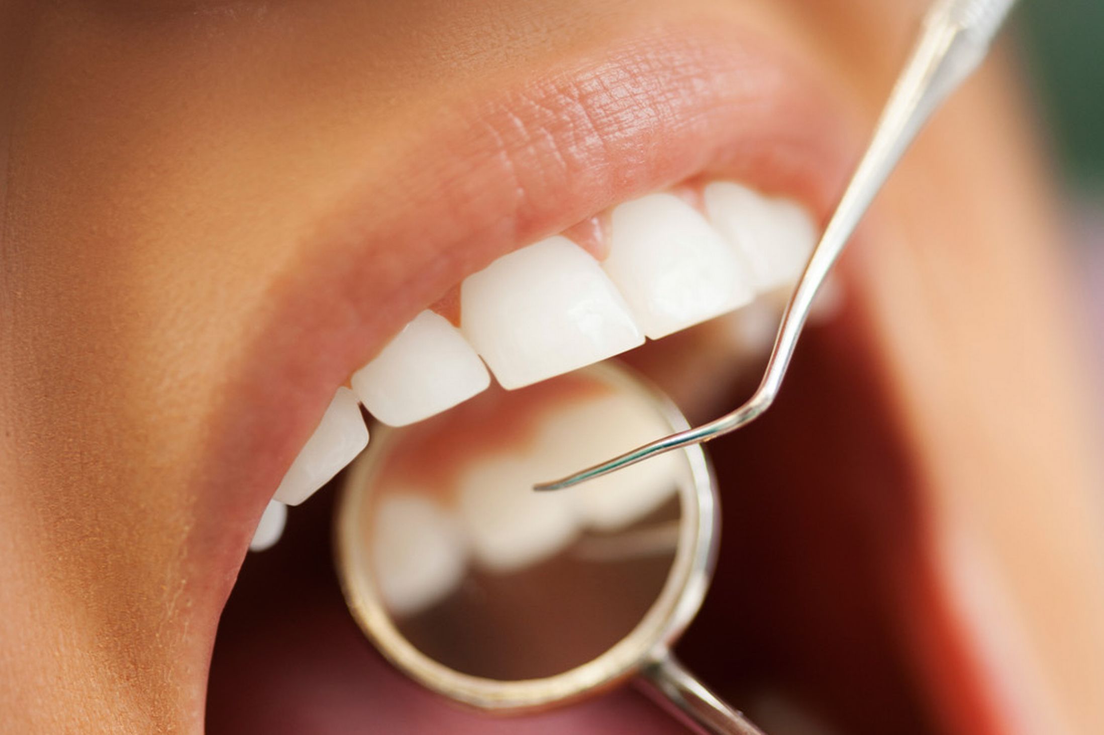 Gestão-de-operadoras-de-odontologia